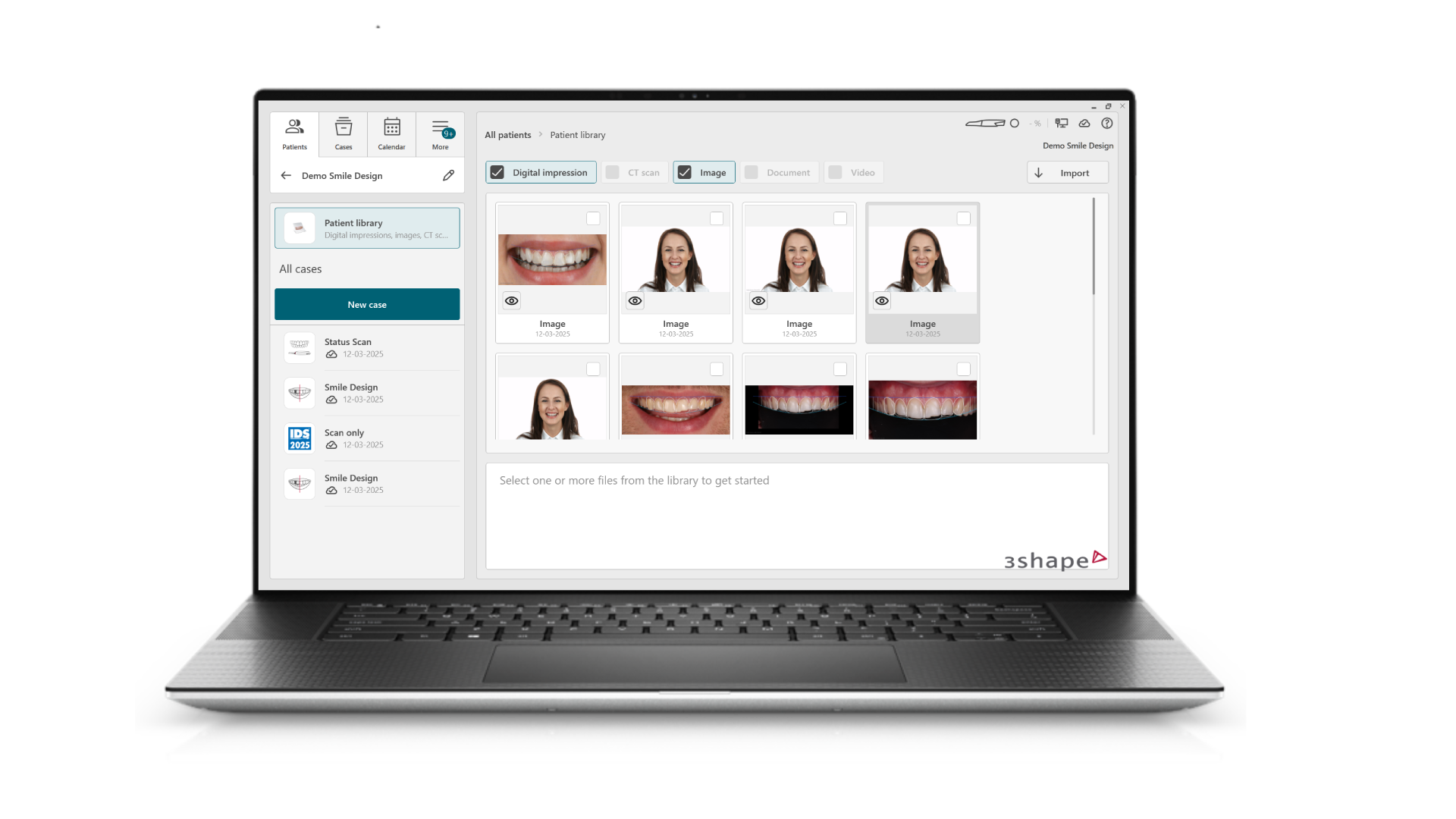 3Shape Dental Software Interface