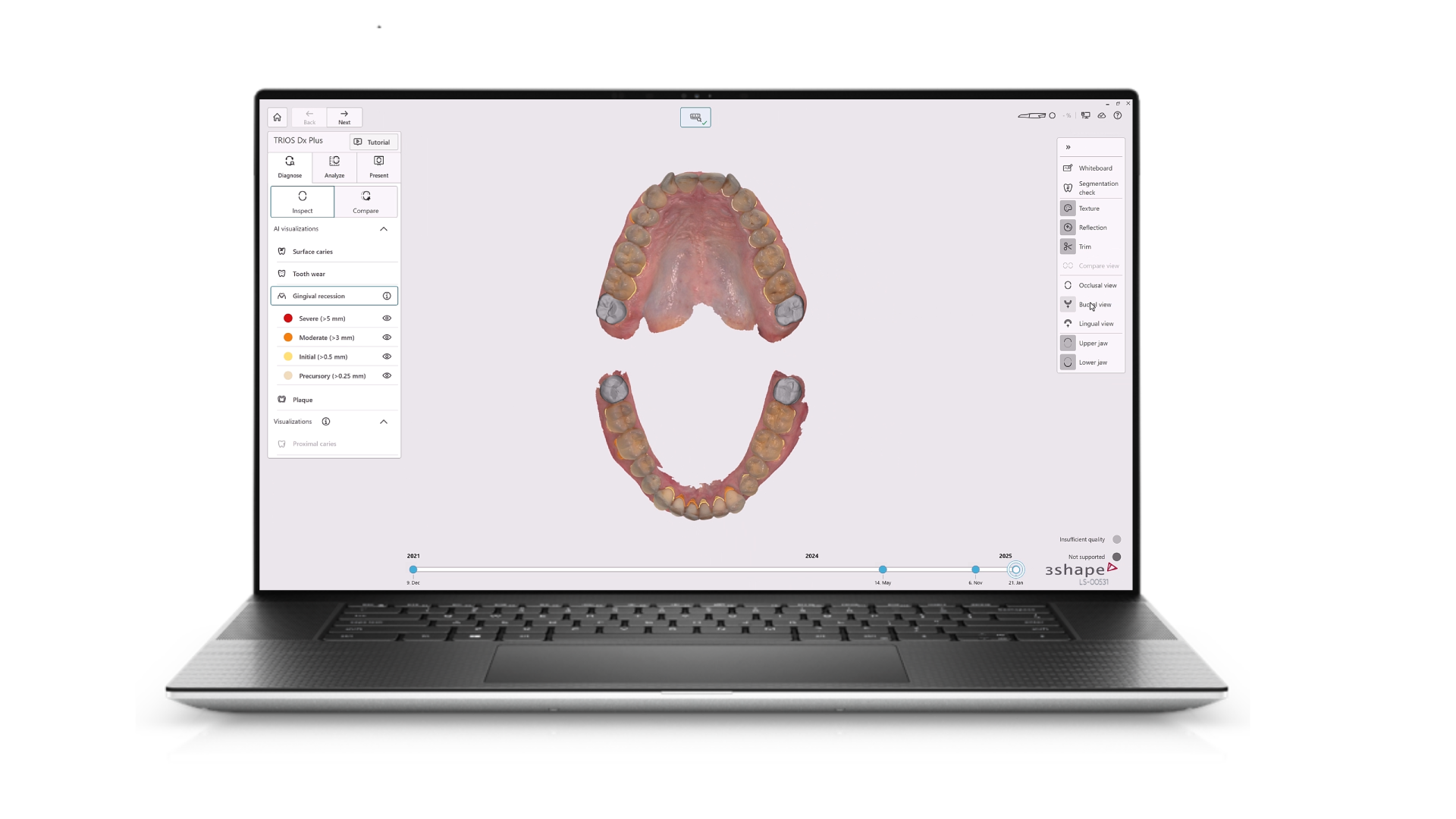 Dental System 3D teeth modeling