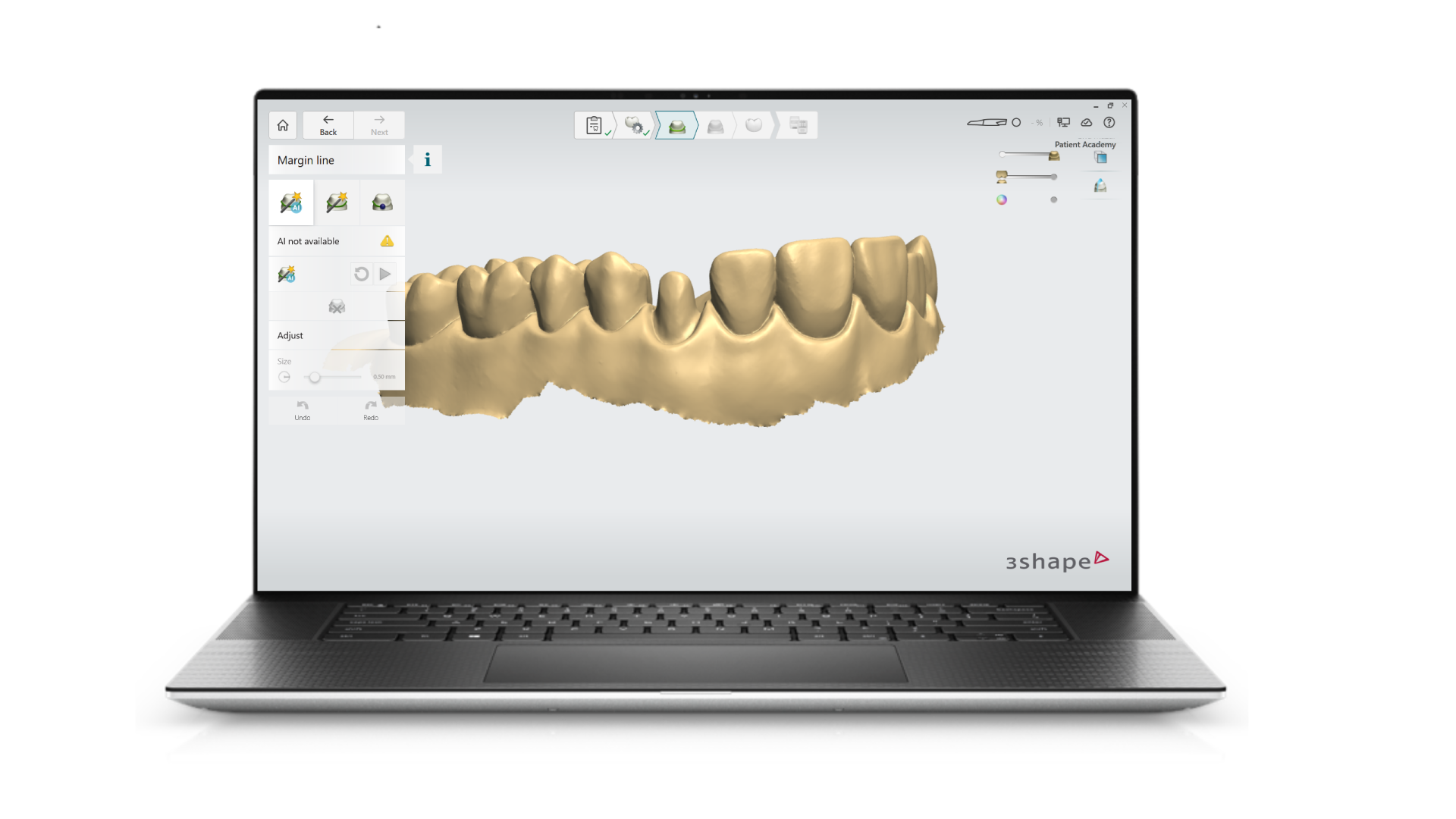 Dental System tooth modeling software