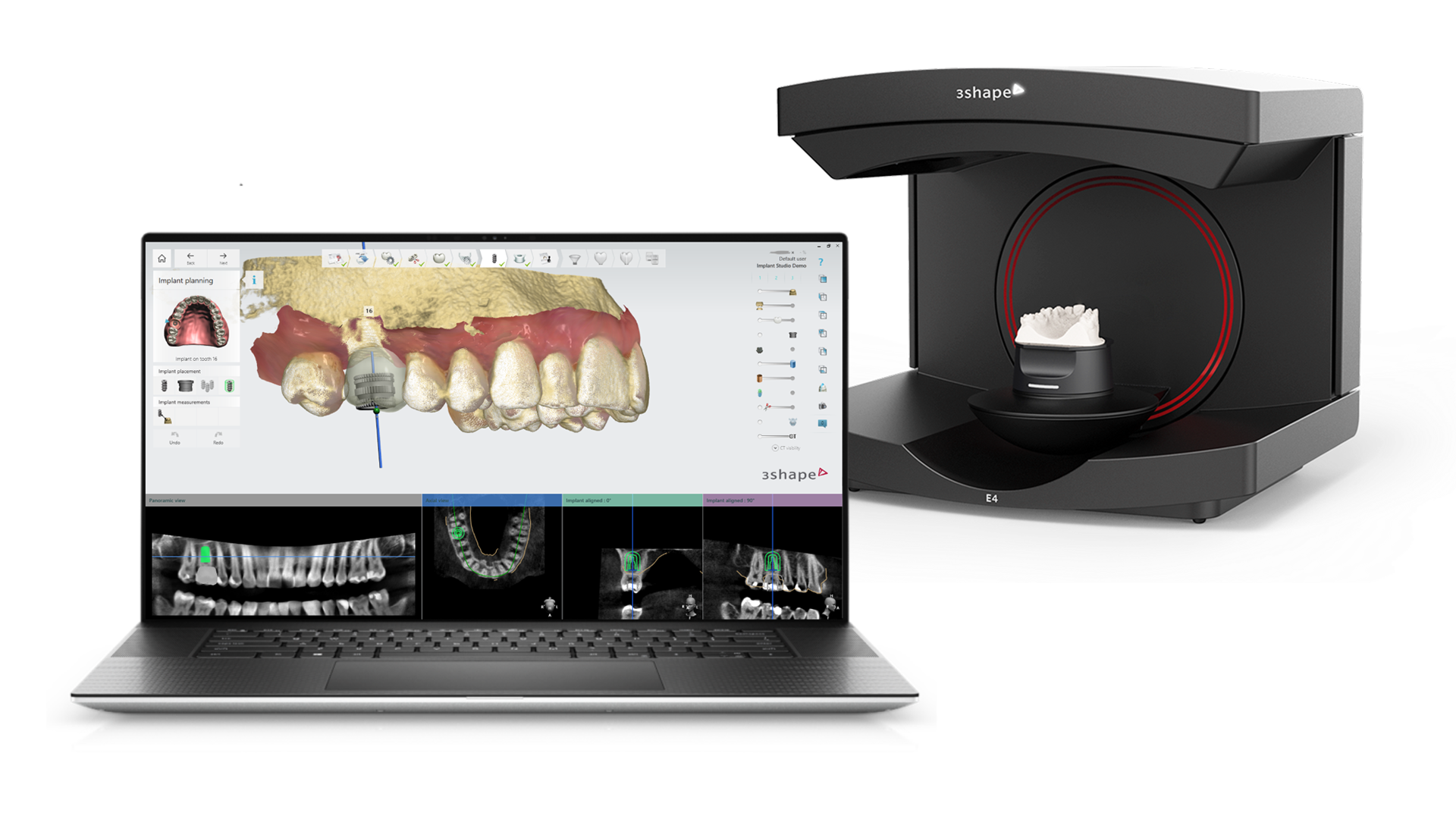 Dental System and E4 Scanner