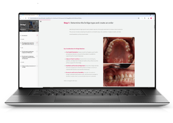 Dental System bridge design interface