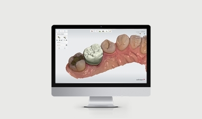 3Shape Dental System software interface