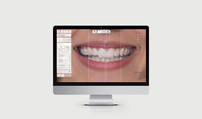 Dental System smile design interface