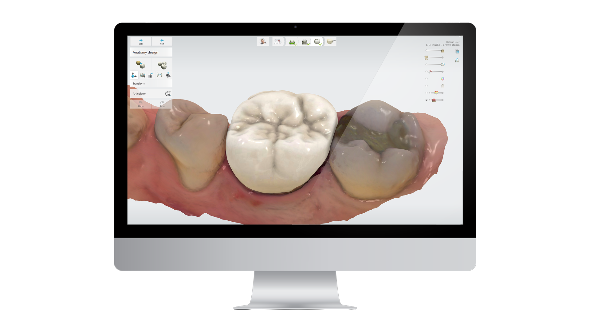 3D dental crown design software