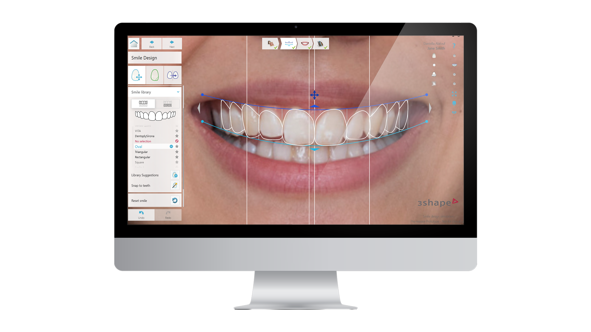 Smile design software interface